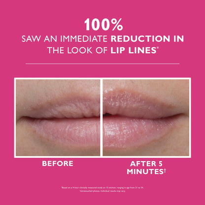 Instant FIRMx Lip Filler|10 ml / 0.3 fl oz