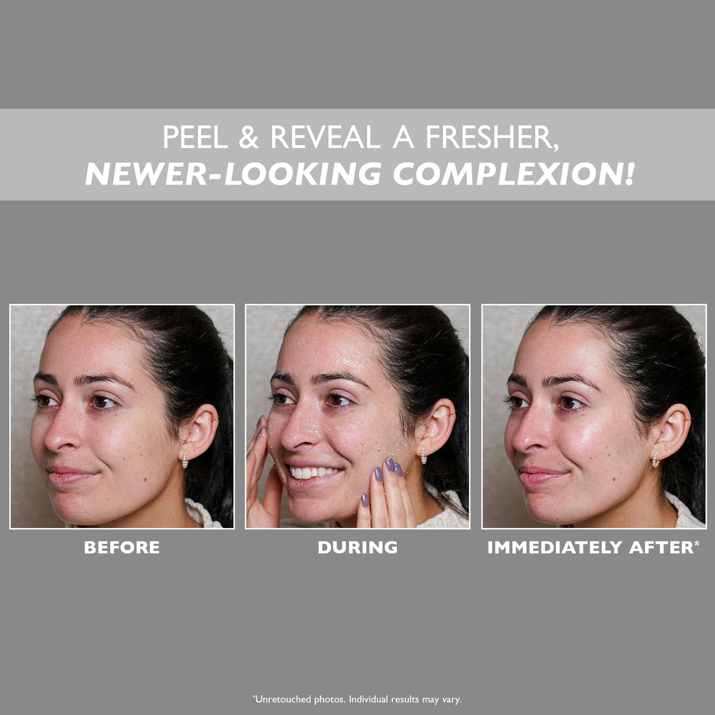 FIRMx Peeling Gel|3.4 fl oz